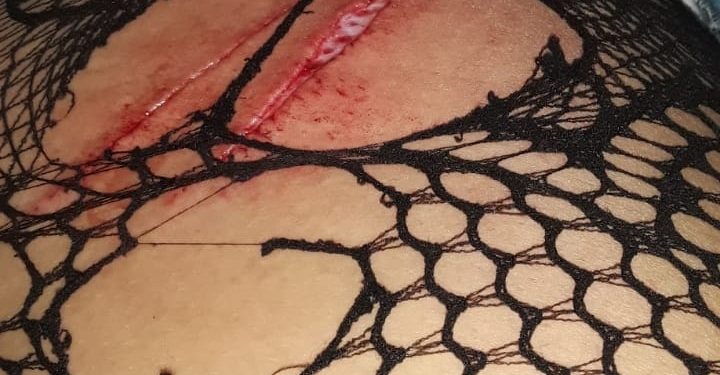 Una mujer fue víctima de múltiples puñaladas, salvó la vida por milagro pero caratularon como “lesiones” y el agresor continúa en libertad