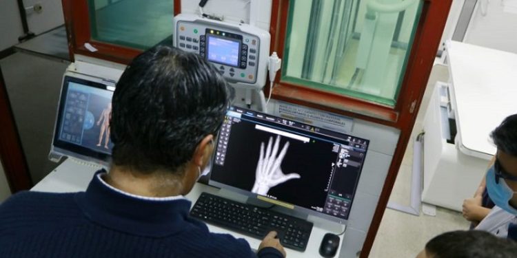 En El Perrando, el gobierno inauguró un nuevo sistema de rayos x que reduce el tiempo de digitalización