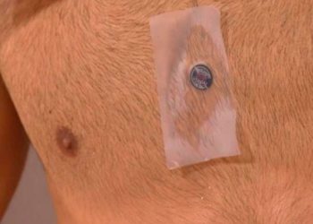 Roland Garros: qué es y para qué sirve el chip electrónico que usa Djokovic