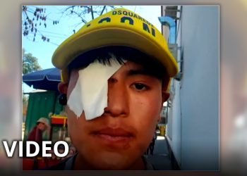Un menor perdió un ojo por una bala de goma que recibió durante la represión policial