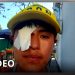 Un menor perdió un ojo por una bala de goma que recibió durante la represión policial