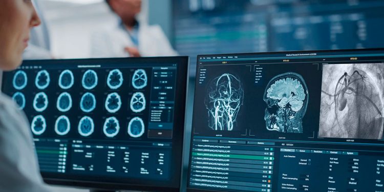 Suben los casos de ACV y crean un asistente virtual con IA para reconocer los síntomas