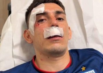 Dos futbolistas argentinos sufren heridas por el ataque al micro de Fortaleza