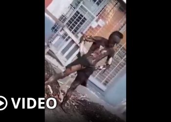 Intentó robar cables de luz y recibió una descarga: quedó con el 90% del cuerpo quemado