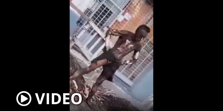 Intentó robar cables de luz y recibió una descarga: quedó con el 90% del cuerpo quemado