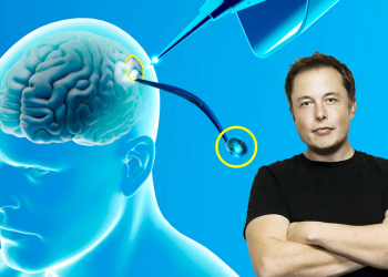 Neuralink, de Elon Musk, está buscando inscribir pacientes en un estudio sobre implantes cerebrales