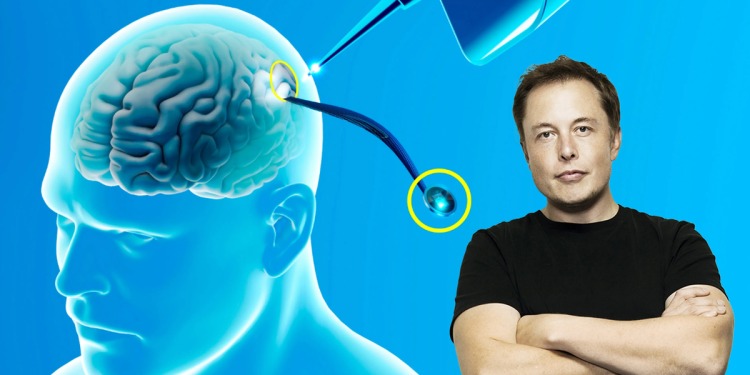 Neuralink, de Elon Musk, está buscando inscribir pacientes en un estudio sobre implantes cerebrales