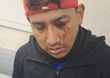 Varios heridos en la represión de una feria del Bajo Flores