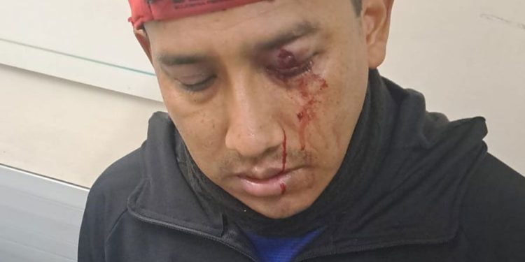 Varios heridos en la represión de una feria del Bajo Flores