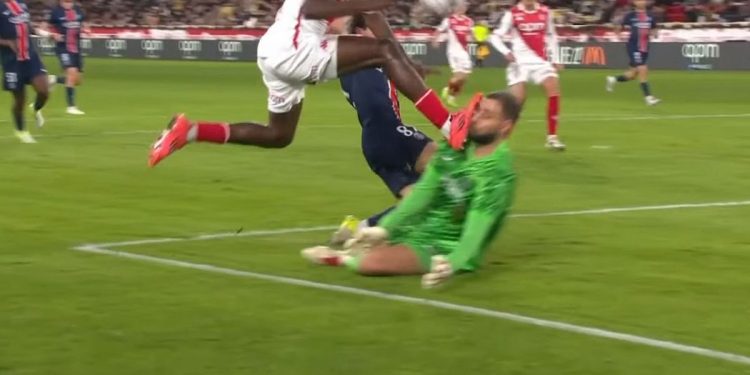 Arquero italiano del PSG sufrió una brutal patada y lo suturaron con clips