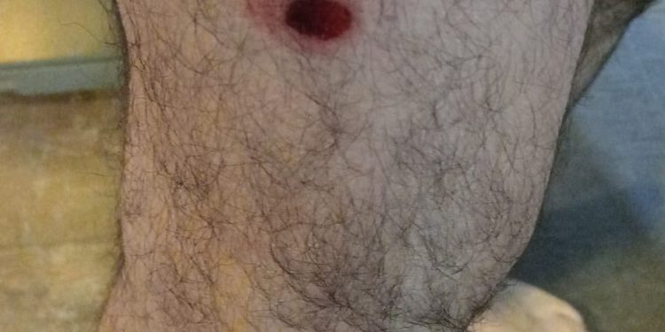 El fotógrafo de Tiempo Edgardo Gómez, herido por las balas de goma de la policía