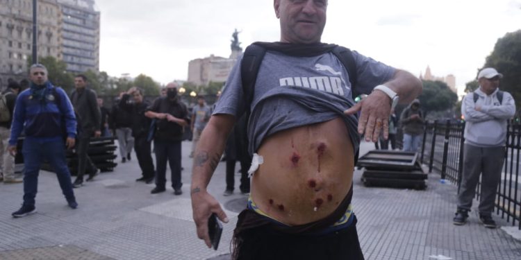 Mientras el fotógrafo Pablo Grillo está muy grave por un disparo en la cabeza de la Policía, Bullrich dijo que estaba preso