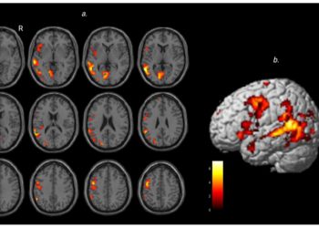 El sarcasmo en tiempos de literalidad «libertaria»