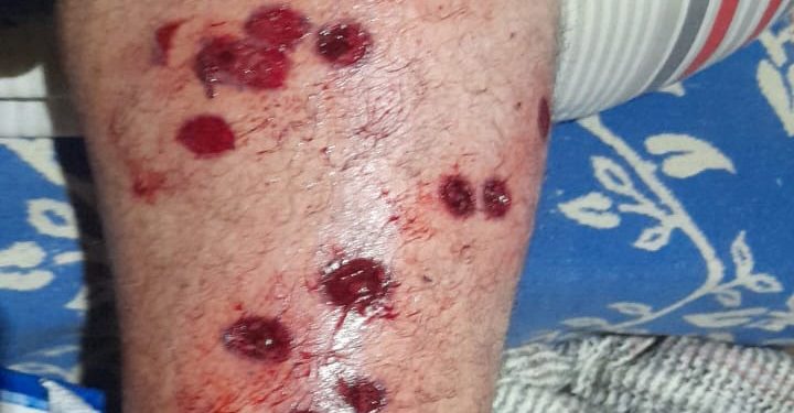 Allanamiento, represión y traslados en la cárcel de Florencio Varela: hay heridos