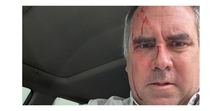 Perú: balearon al candidato presidencial Rafael Belaunde Llosa