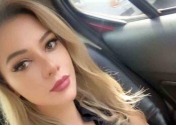 “Que Dios te perdone, Fernando Cerimedo”: Nadia Beller compartió imágenes de sus heridas tras el ataque