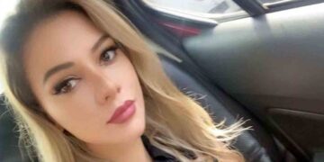 “Que Dios te perdone, Fernando Cerimedo”: Nadia Beller compartió imágenes de sus heridas tras el ataque